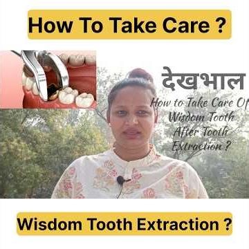 ✅Do's & Don'ts ❌ After Tooth Extraction .?