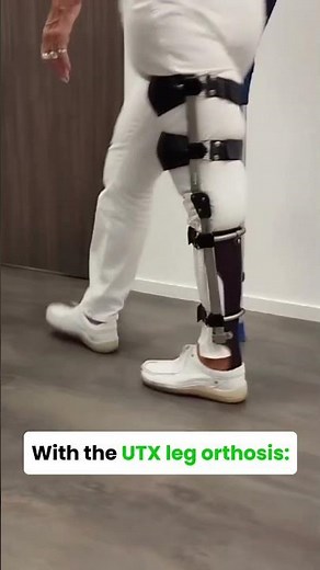 Hyperextension of the knee, before and after the UTX leg brace