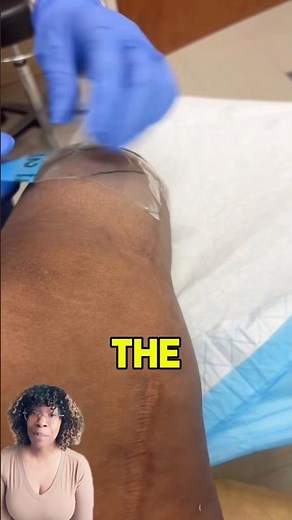 Wound vac process in nursing #shorts