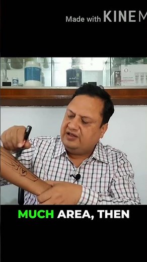 Small Tattoos vs Large: Removal Cost Breakdown #comparison #tattoo #money