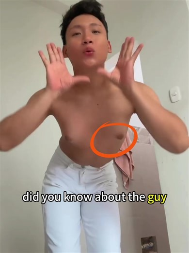 Did you know about the guy who was born with a female chest? He lives in sunny, hot Brazil #didyouknow #storytime #67 #animated #urbanlegend