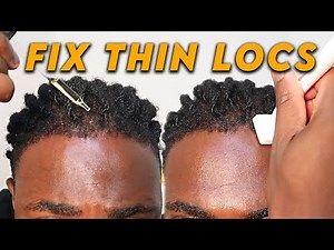 How to Fix Thinning Dreadlocks & Receding Hairline | DHT Blocker & Derma Stamp Tutorial for Growth