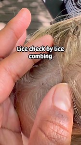 316K views · 1.4K reactions | Lice combing is the best way to check for lice. It is more accurate and you’ll be able to see lice more clearly. ￼Also getting the right lice comb is key as well. I definitely would recommend getting the lice comb that I use in my videos. They are durable and won’t brake and will pull out both the bugs as well as the nits ( lice eggs) . Just click the link in my bio. ￼#lice #momlife #hair #piojos #explore #backtoschool | Stacey The Louse Lady | Facebook