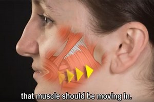 Paresis - an introduction and exercises - Facial Palsy UK