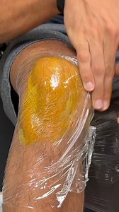 See how to instantly eliminate knee pain without taking medicine! | Top Tips