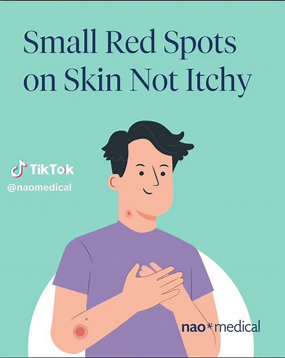 Small Red Spots on Skin Not Itchy: Causes, Symptoms, and Treatment