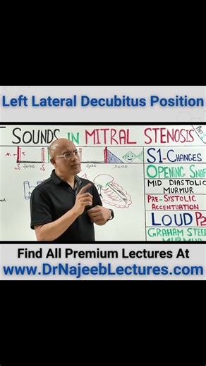 Understanding Left Lateral Decubitus Position in Medicine