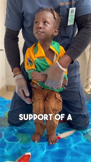 3-year old Ezekiel Adena physiotherapy session in our facility.