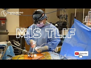 L4-5 & L5-S1 MIS TLIF: Fixing Severe Stenosis & Spondy
