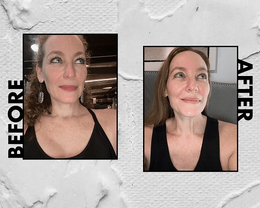 I Tried Sofwave Skin Tightening on My Face and Neck—Here's My Honest Review