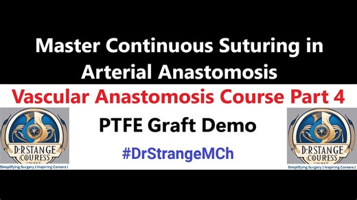 Arterial Anastomosis – Continuous Suture Technique Explained | Vascular Anastomosis Course 4 HD YTS?