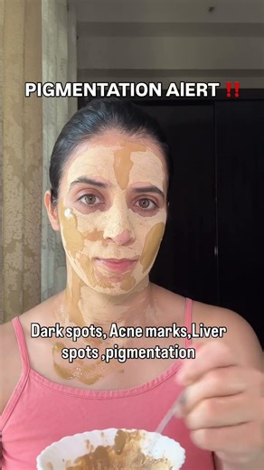 Dark spots, acne marks, and pigmentation