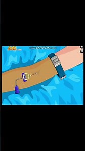 LOPERATE NOW! APPENDIX SURGERY #игры #game-game #operatenow #хирург #подпишись #повар