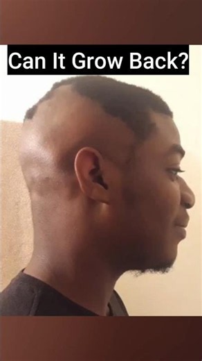 🤔 If You Have a Bald Spot...