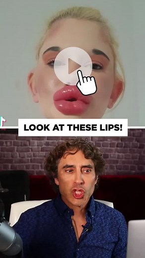 BIGGEST LIPS EVER MADE!!Lip fillers are ever popular but these may be the biggest lips ever made. #lipfiller