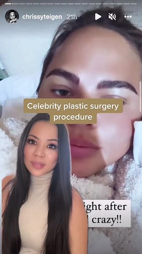 Eyebrow Transplants: Procedure, Results, and Maintenance