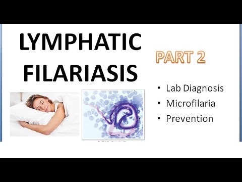 PSM 290 Lymphatic Filariasis Part 2 Lab Diagnosis Microfilaria Prevention DEC Provocation Test