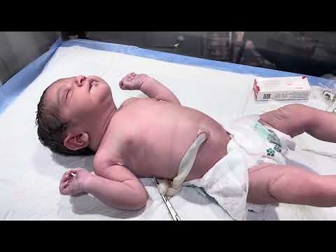 Newborn First Management 👶 | Essential Neonatal Care & First Steps #NewbornCare #neonatal