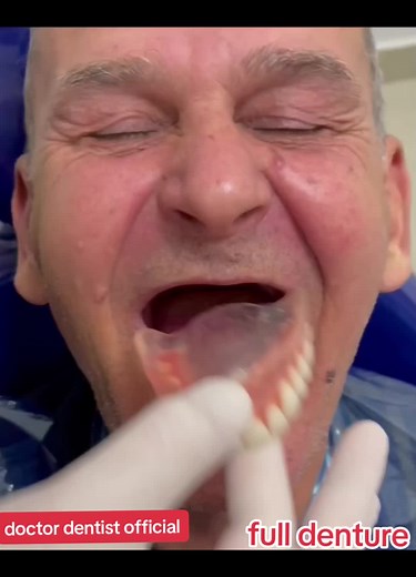 Comprehensive Guide to Full Dentures by Doctor Dentist