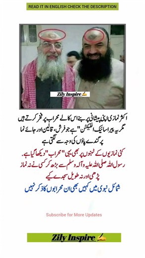 Forehead Marks Are Not a Proof of Piety 🕌 #IslamicReminder #PrayerEtiquette #Sujood #Hadith #Namaz