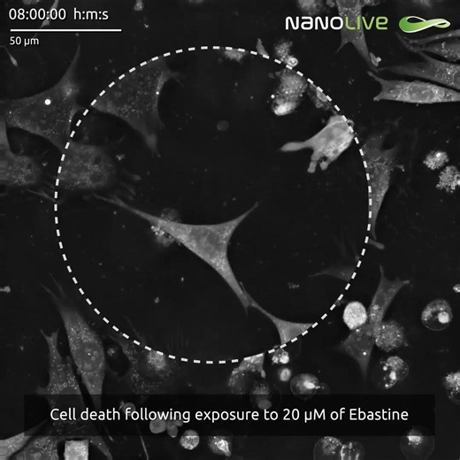Cell death following exposure to 20 µM of Ebastine
