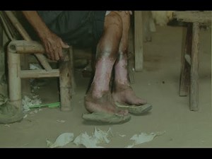 Photos of Japanese Biological Warfare in China Displayed in Tokyo