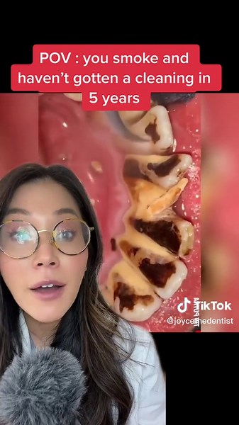 How Smoking Affects Your Teeth | Dental Hygienist Tips