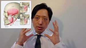 In this edition of “Med Tutor” I continued with Cranial Nerve review. Cranial Nerve five (CN V), Trigeminal Nerve has two main functions: one is to provides sensation innervation to the face and the second function is provide motor innervation to the muscles derived from the first pharyngeal arch. There are quite a lot of branches to Cranial nerve 5 so today, I concentrated on the motor part of the cranial nerve five which is the Special Visceral Efferent fiber (SVE) of the Mandibular nerve (V3)