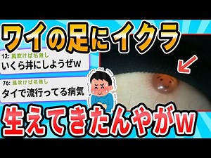 【2ch面白いスレ】ワイの足がヤバい事になったｗ