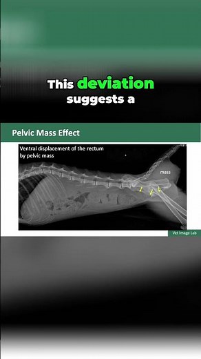 Pelvic Mass Effect: Identifying Signs & Causes Explained #shorts