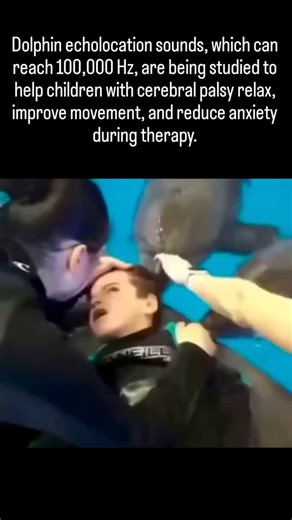 explain.io on Instagram: "Dolphin echolocation emits ultrasonic clicks up to 100,000 Hz, far beyond human hearing (20-20,000 Hz), and preliminary studies like a 2020 PMC analysis of EEG signals during dolphin-assisted therapy (DAT) suggest these vibrations may reduce anxiety and enhance motor function in children with cerebral palsy by influencing neural relaxation. Research, including a 2003 ScienceDirect paper on ultrasound's biological effects and a 2025 review of the Euterpe method, indicate
