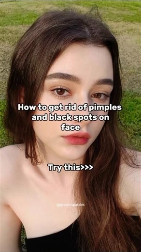 How to Get Rid of Pimples and Black spots on Face #pimpleproblem #pimplescars #blackspot #skincare
