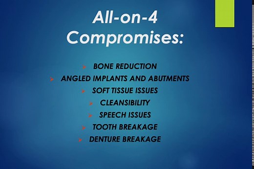 Alternatives to All-on-4 with Pics - Dental Implant Center