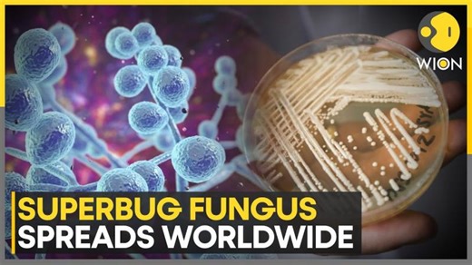 Superbug Fungus on the Rise Worldwide, Experts Warn of Troubling Strains | WION | Henry Mbah