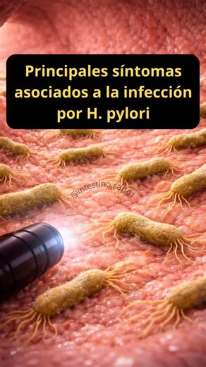 Carla M. | Intestino Sano on Instagram: "H. pylori es un tipo común de bacteria que crece en el tracto digestivo y tiende a atacar la mucosa gástrica. H. pylori suele infectar el estómago durante la infancia. Aunque las infecciones con esta cepa bacteriana no suelen causar síntomas, en algunas personas pueden causar enfermedades, como úlceras pépticas y gastritis. Algunos síntomas de H. pylori incluyen: dolor y ardor de estómago, distensión abdominal, náuseas, pérdida de peso, eructos y pérdida 