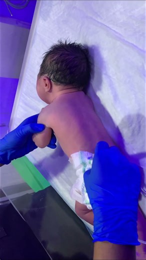 Initial Assessment Of Cute Baby#cute #newborn