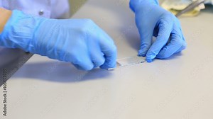 Preparation of smear. Applying a drop of blood on glass slide, and the erosion of its cover glass. Stock Video