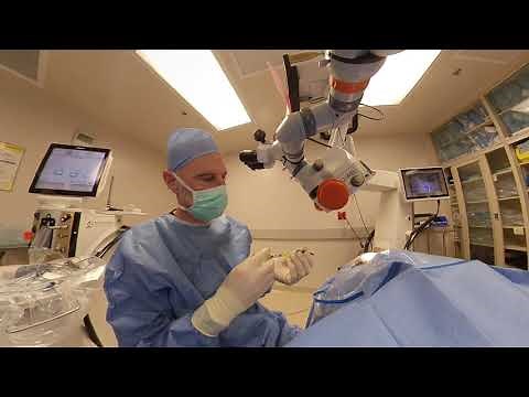 Cataract Surgery with Omni dilation and Hydrus