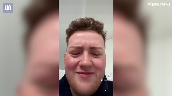 Welsh man stuck with apple sticker in his ear for years clears it out with earwax