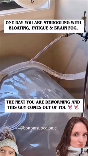 Danica | This procedure is called a colonic. Colonics don’t kill parasites — they remove what the cleanse is loosening. They help flush out... | Instagram