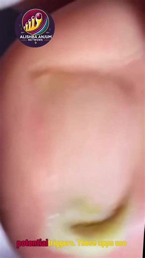 277K views · 1.9K reactions | Natural Nail Care for Thick Toenails with Gentle Daily Routine #SeniorNailCare #GentleToenailCare #WellnessNails | Alishba Anjum vlog | Facebook