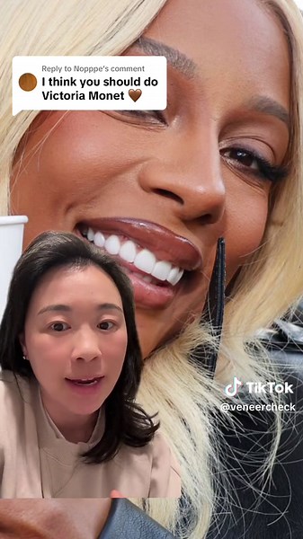 Victoria Monet: Nose Job, Teeth, Before and After, Veneer Check