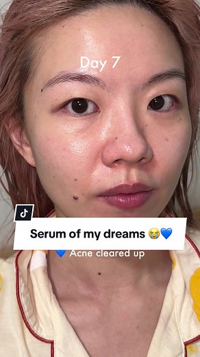 I cannot go a night without this serum now 😍 Just when I thought @Fresh Beauty couldn’t get any better, they come up with the new Lotus Dream Serum. My skin is the smoothest it has been in ages, and not to mention how radiant this made my skin too?? They meant it when they named this a dream serum 🥹 #freshlovesg #freshlotus #skinofyourdreams