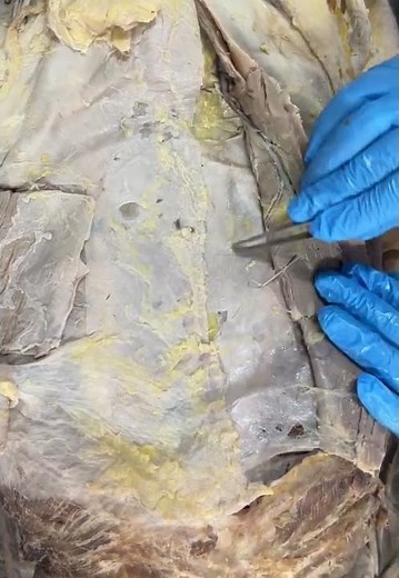 Anatomy: Rectus Sheath Posterior Wall Explained #anatomy