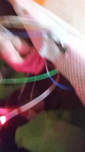 Locate Fiber Optic Cable Faults Easily with a Visual Fault Locator #visual fault locator #VFL #fiber optic troubleshoot #followerseveryonehighlights #TelecomTech | Ginobili Nituc Eterrab