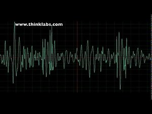 Atrial Septal Defect