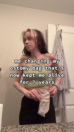 History of the First Successful Colostomy Bag Surgery