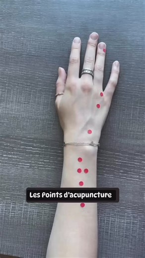 Le méridien du San Jiao / Triple réchauffeur (TR) ou 3 Foyers (TF) est fantastique pour éliminer l’Humidité et la Chaleur, en particulier ! * TR 1 expulse les agents pathogènes en cas de fièvre élevée, de mal de gorge et d’yeux rouges. * Les points d’acupuncture TR 2 & TR 3 sont utilisés en cas d’acouphènes, d’yeux rouges et gonflés, et de céphalées temporales. * TR 4 est le point Source Yuan du San Jiao, utilisé en cas de syndrome de Shao Yang (frissons et fièvre alternants). * TR 5 est le poin