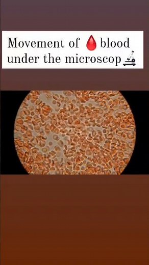 Movement of Blood 🩸 Under Microscope 🔬 Satisfying.