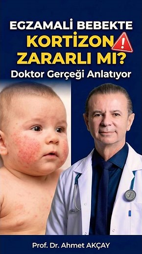 Is Cortisone Harmful for Babies with Eczema? A Doctor Explains the Truth